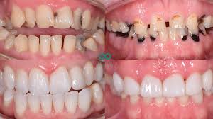 Cosmetic Dentistry